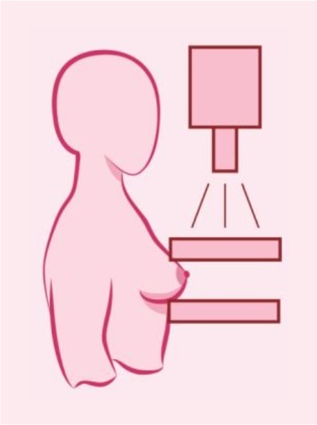 Breast Cancer - Background